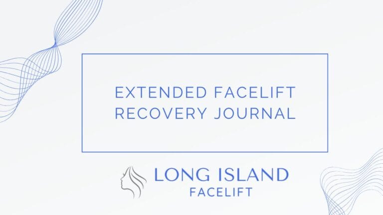 Extended Facelift Recovery Journal