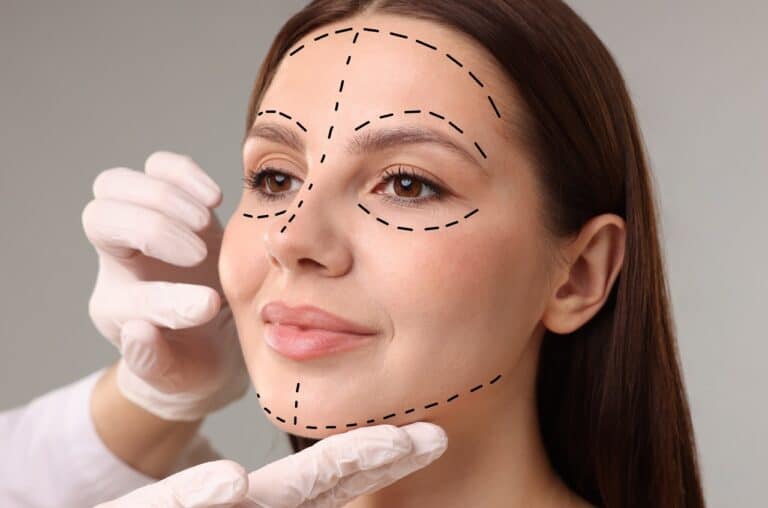 facelift marks on woman's face